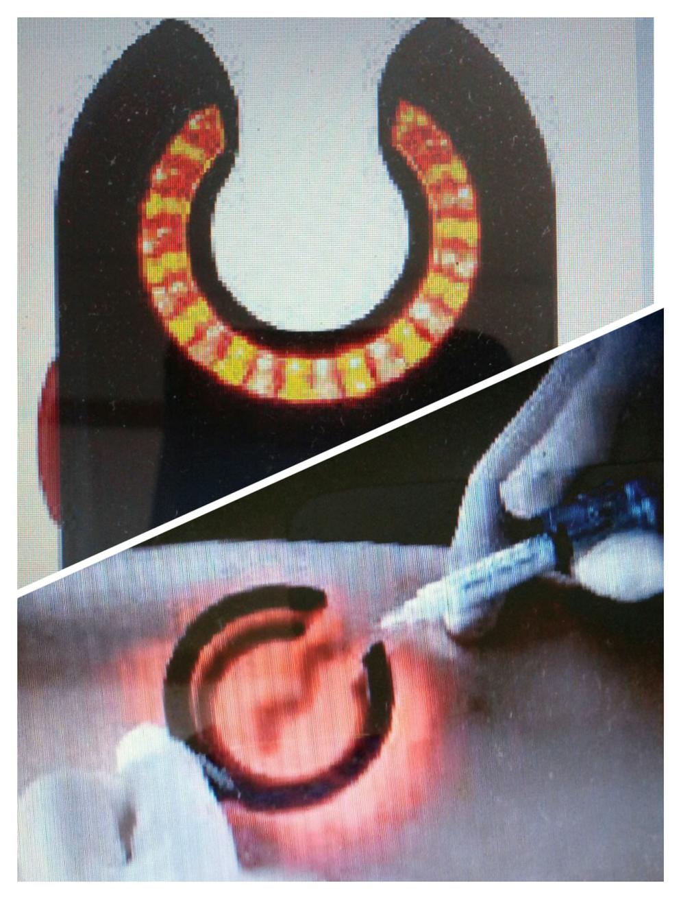 Medical Vein Finder