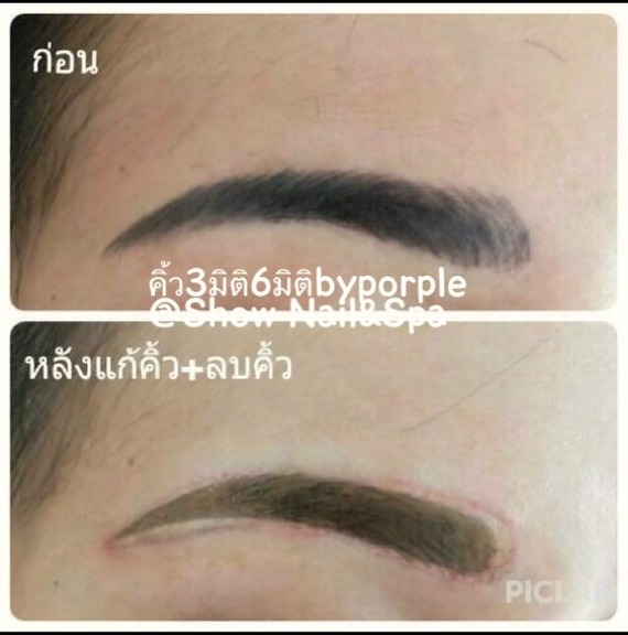 รับปรึกษาปัญหาเรื่องคิ้ว แก้ไขทรง